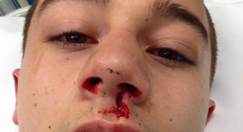 Jongen (16) mishandeld na verjaardag